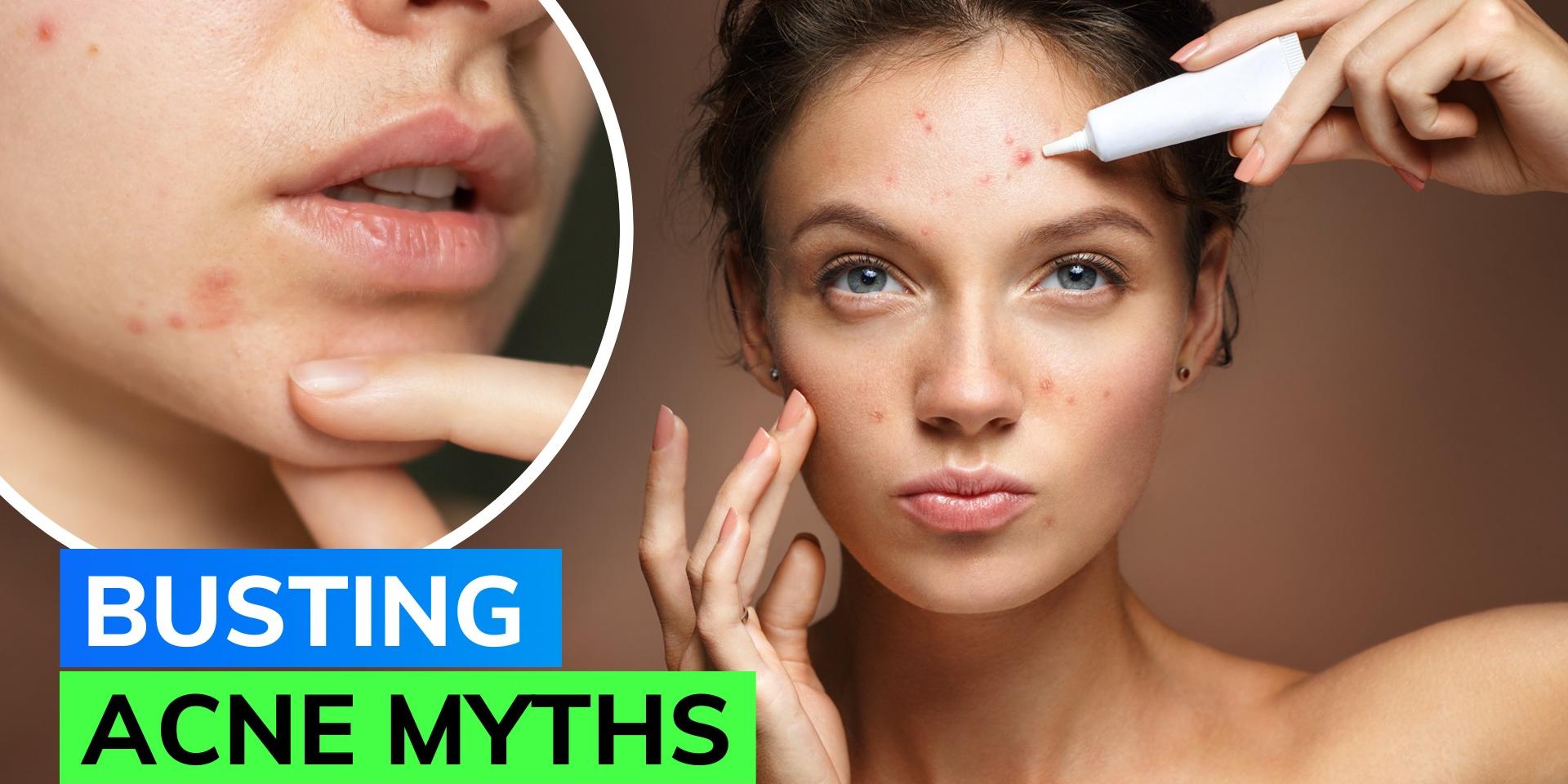 Dermatologist debunks common acne myths you should stop believing ...
