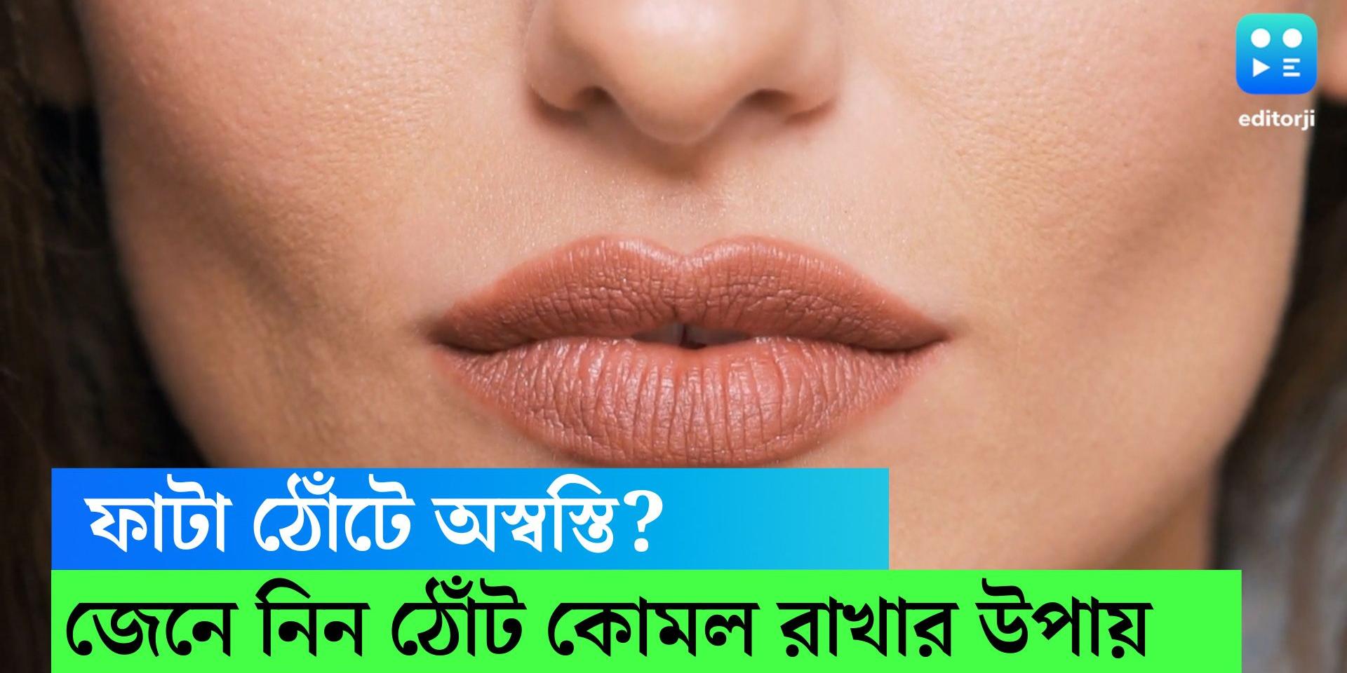 Lips Care How to keep lips soft and dry free, hereʼs some tips for