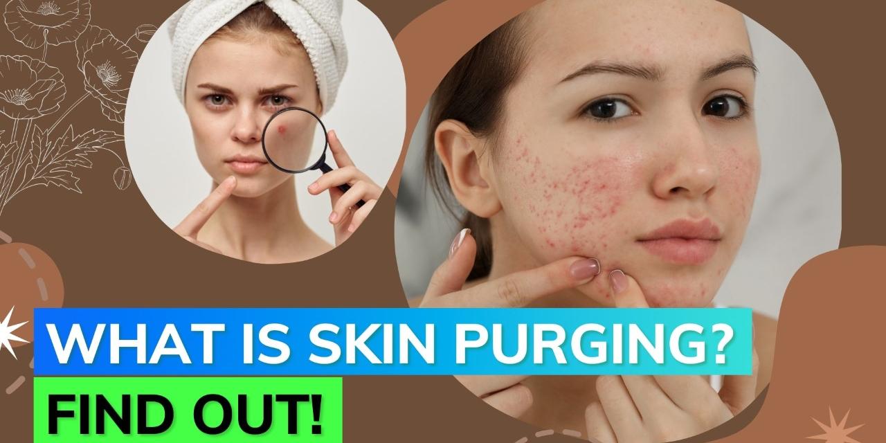 familiar-with-the-term-skin-purging-here-s-everything-you-need-to-know