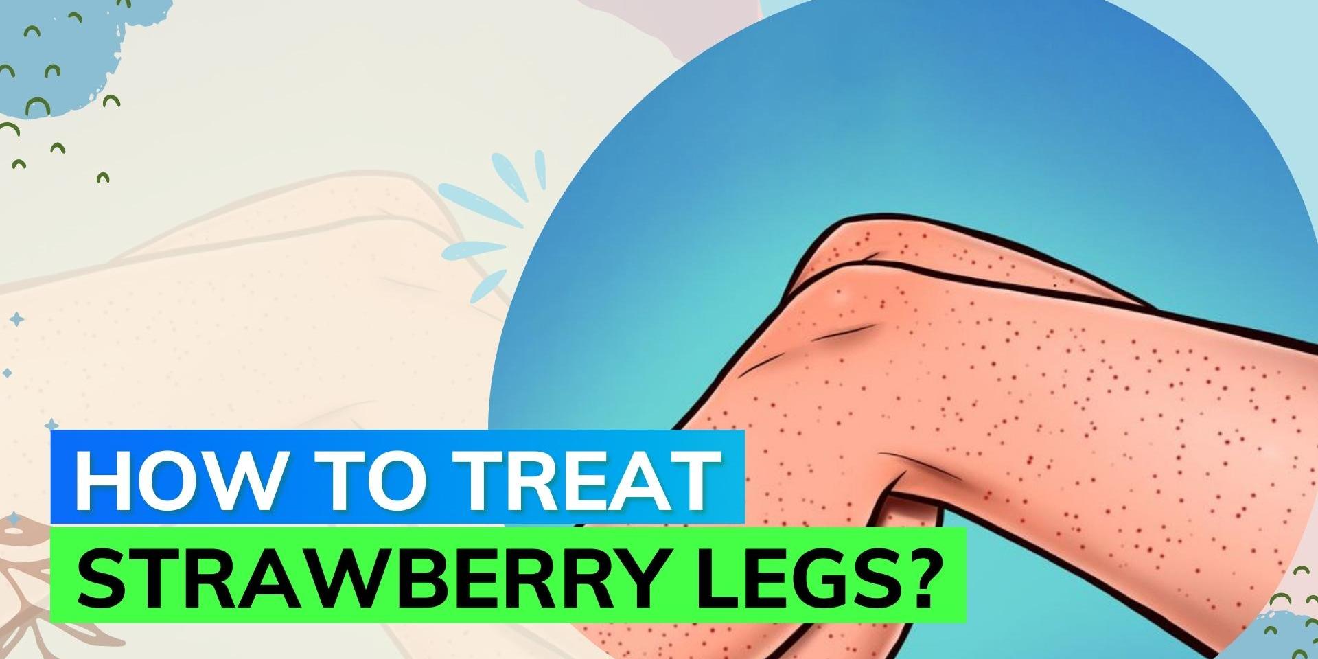 Tired of strawberry legs? Here‘s how you can get rid of it! Editorji
